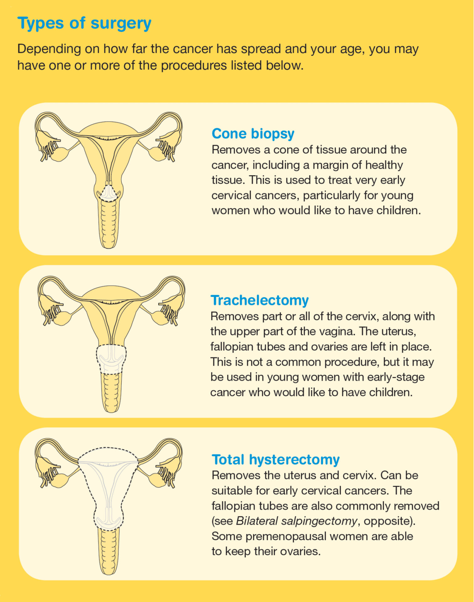 Types Of Cysts On Cervix